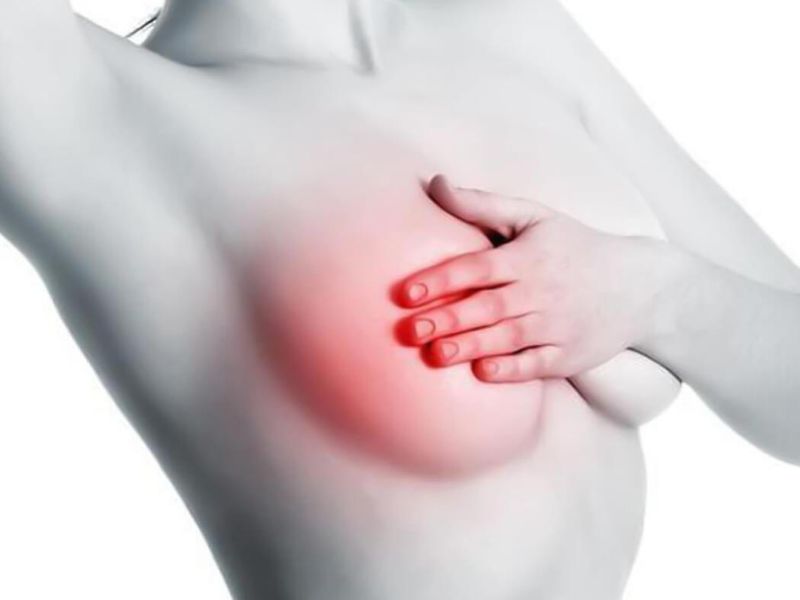 tam-soat-ung-thu-vu-3