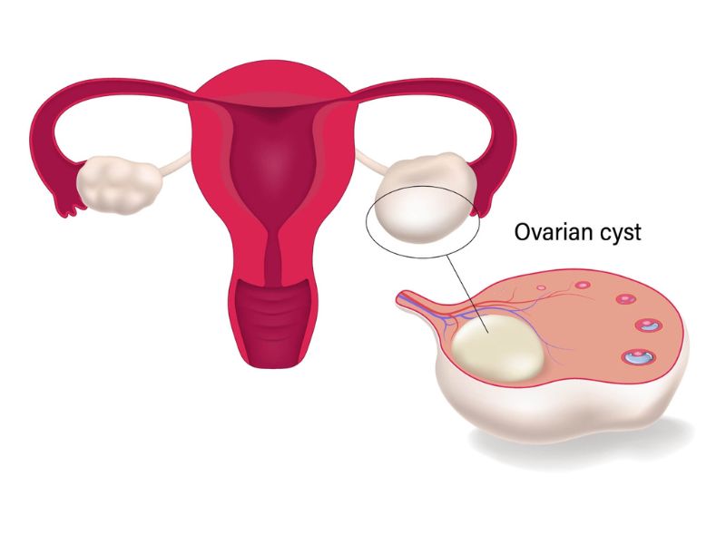 u-nang-buong-trung-6