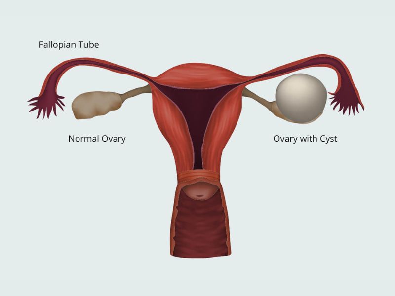 u-nang-buong-trung-2