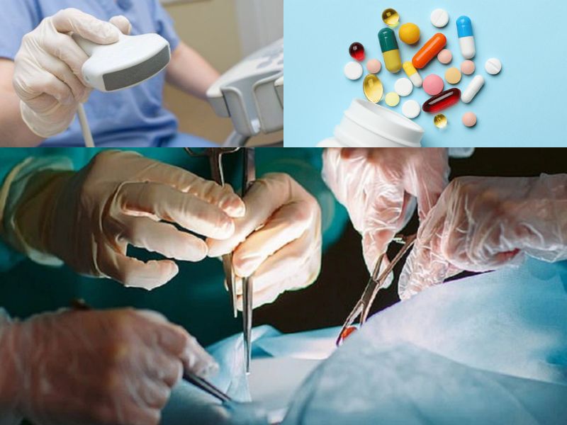 u-nang-buong-trung-8