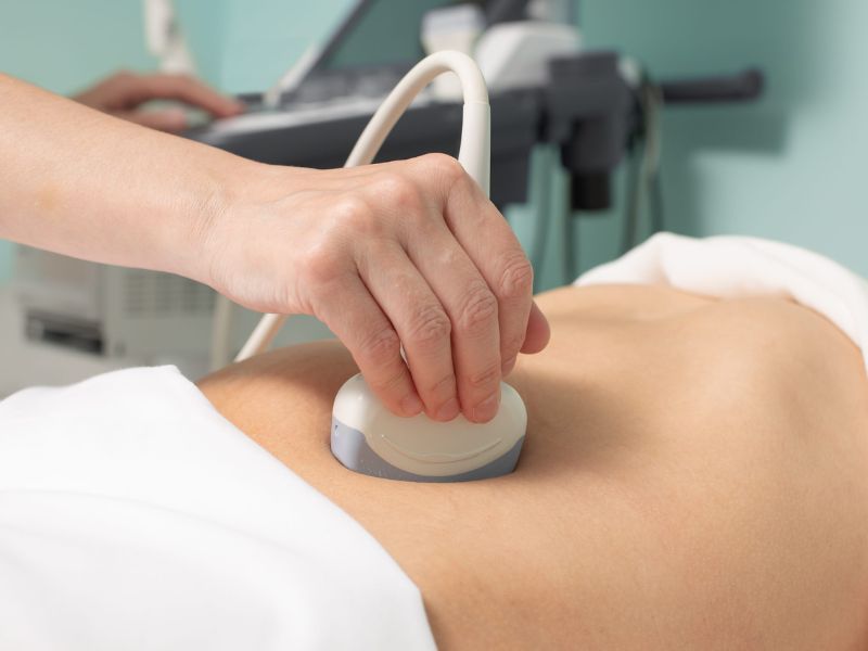 u-nang-buong-trung-7