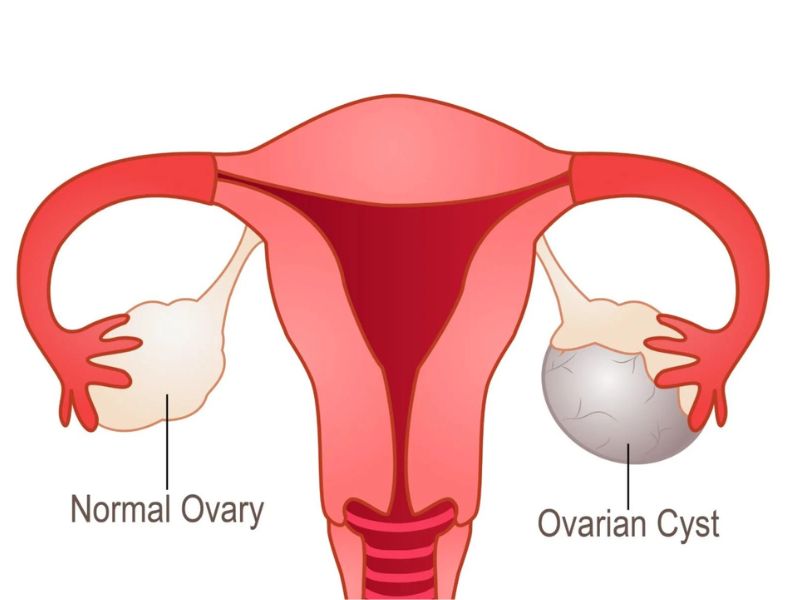 u-nang-buong-trung-3