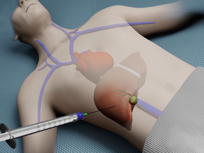 xet-nghiem-ung-thu-gan-5