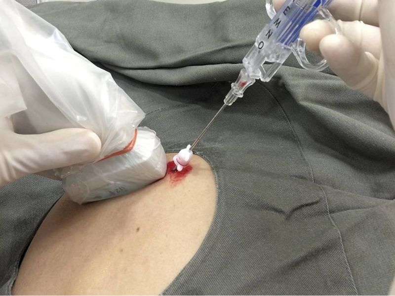 sinh-thiet-duoc-thuc-hien-nhu-the-nao-3