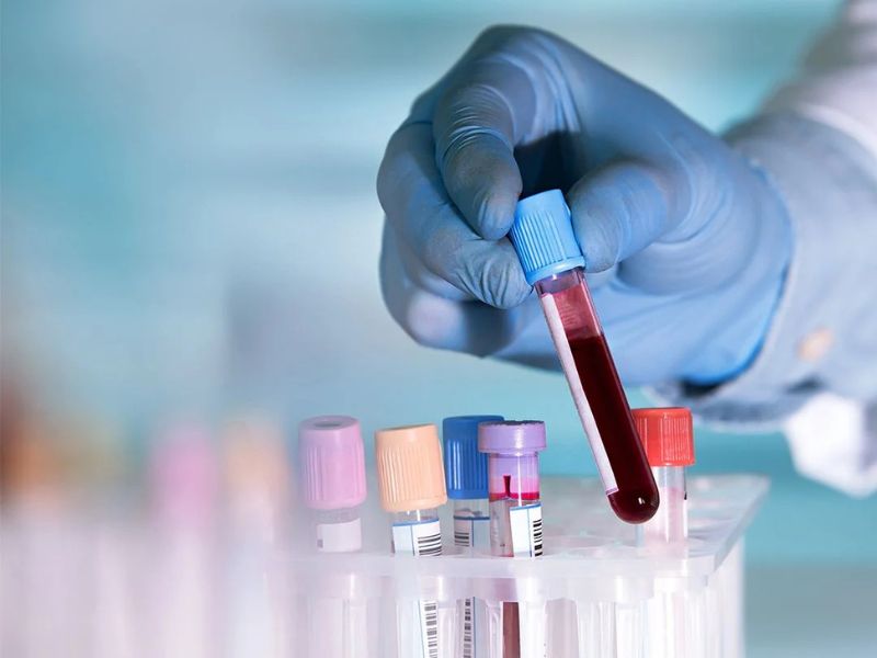 sinh-thiet-duoc-thuc-hien-nhu-the-nao-8