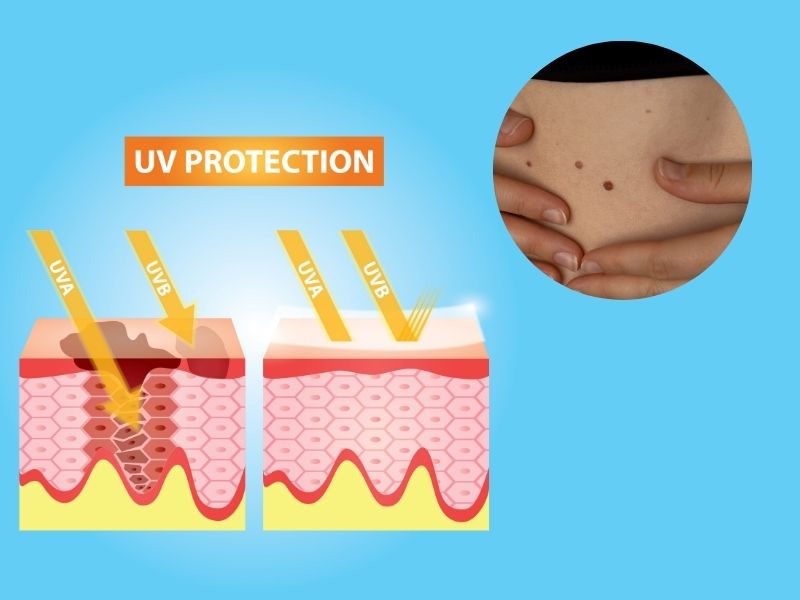 tia-uv-co-gay-ung-thu-khong-4