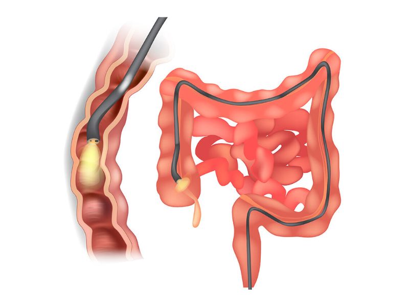 noi-soi-dai-trang-co-dau-khong-4