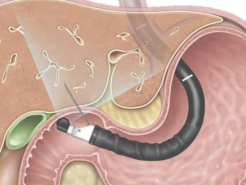chan-doan-ung-thu-da-day-4