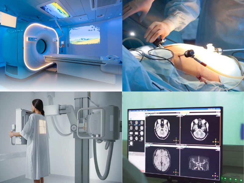 chan-doan-ung-thu-da-day-9