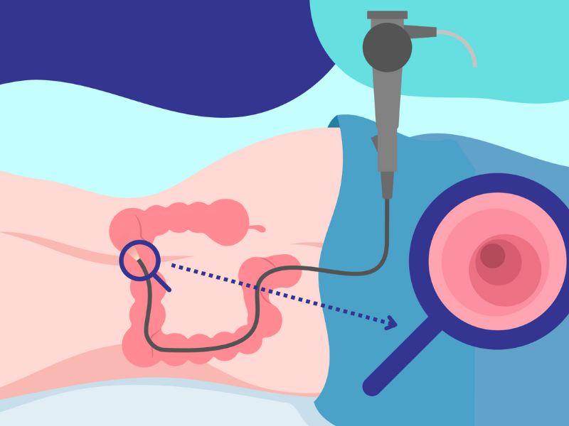 noi-soi-dai-trang-co-dau-khong-2