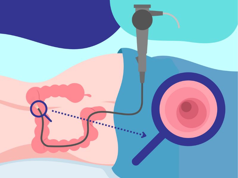 khoang-cach-giua-2-lan-noi-soi-dai-trang-2