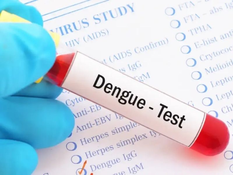 xet-nghiem-sot-xuat-huyet-3