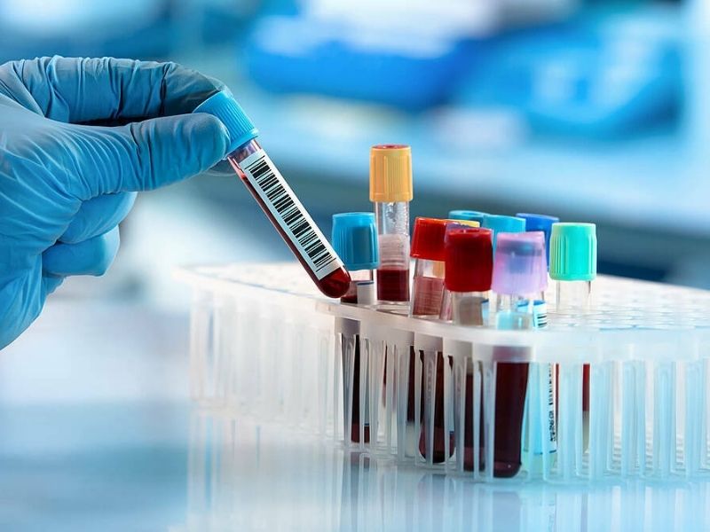 xet-nghiem-sot-xuat-huyet-4