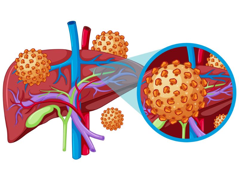 viem-gan-b-lay-qua-duong-nao-2
