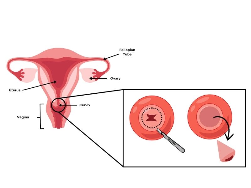 sinh-thiet-co-tu-cung-co-anh-huong-gi-khong-2