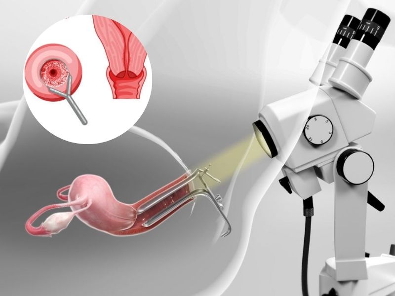 sinh-thiet-co-tu-cung-co-anh-huong-gi-khong-4