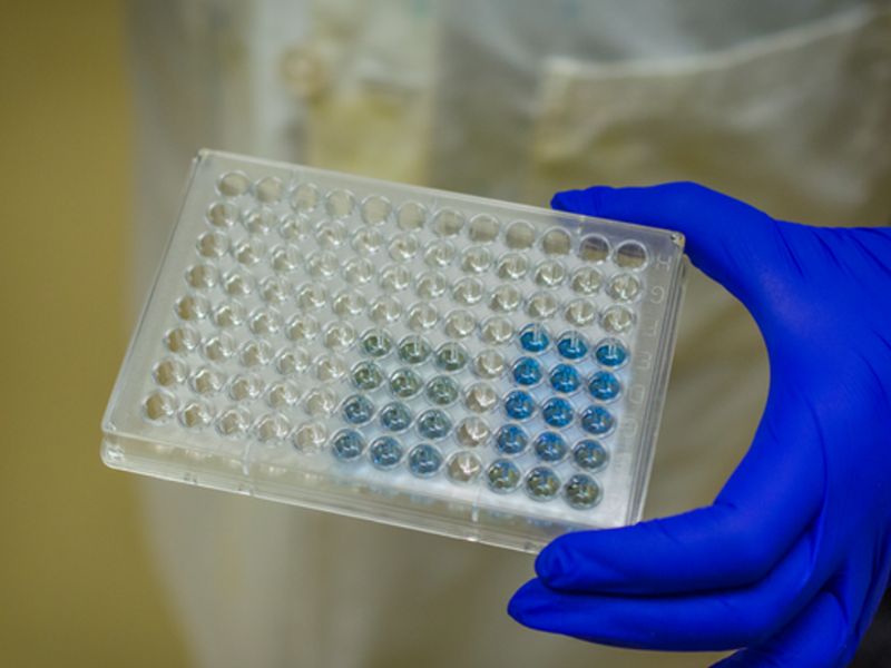 xet-nghiem-sot-xuat-huyet-8