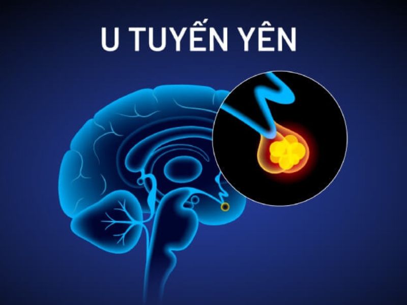 u-tuyen-yen-1
