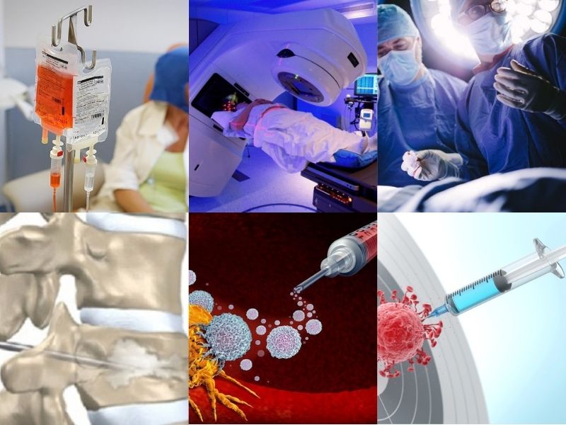 ung-thu-vu-di-can-xuong-5