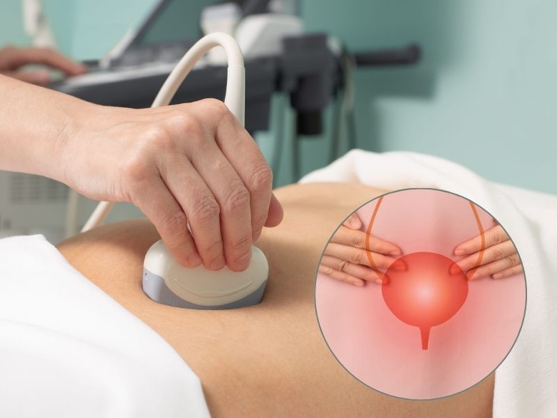 sieu-am-bang-quang-1