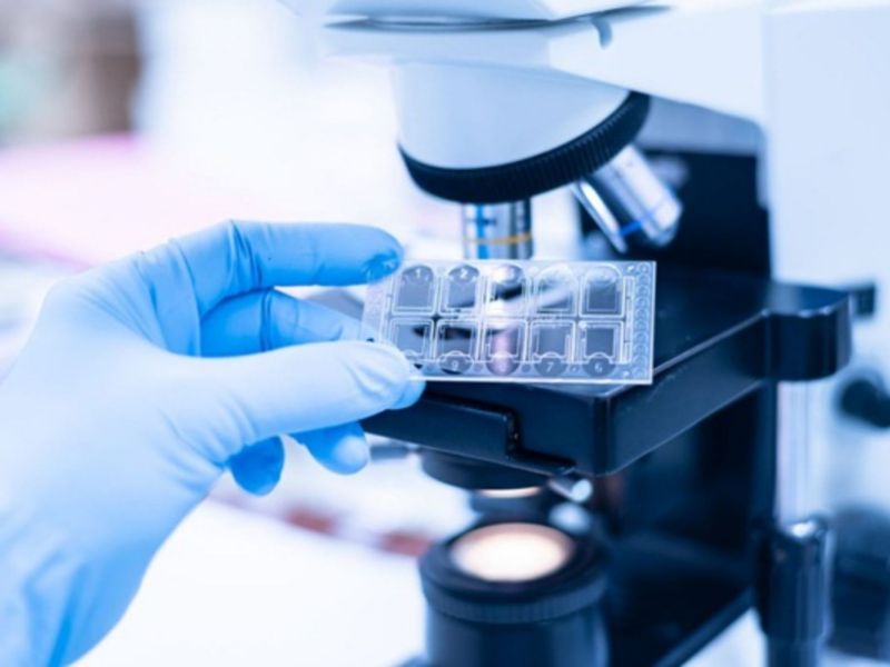 giai-phau-benh-trong-chan-doan-va-dieu-tri-ung-thu-3