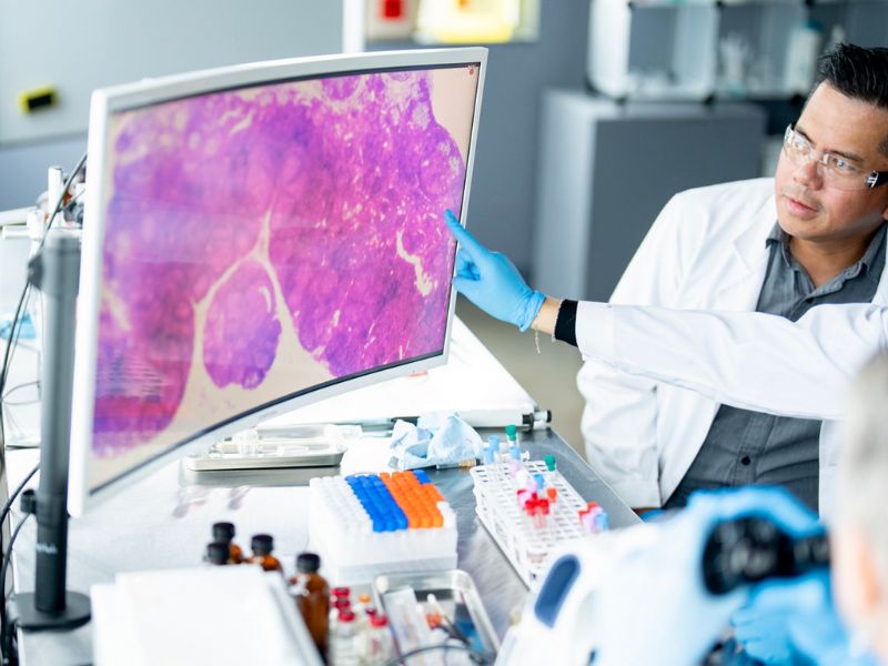 giai-phau-benh-trong-chan-doan-va-dieu-tri-ung-thu-4