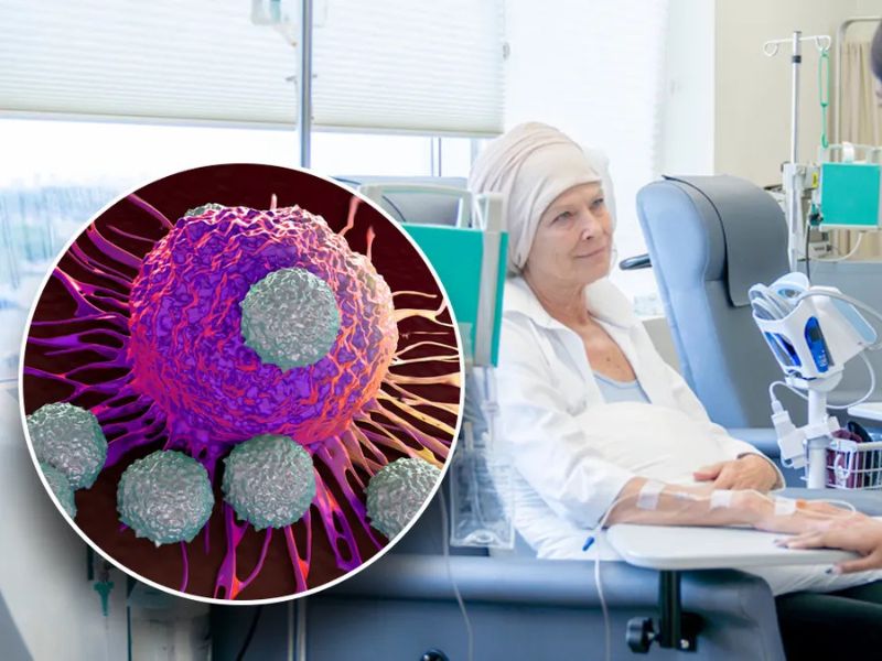 giai-phau-benh-trong-chan-doan-va-dieu-tri-ung-thu-2