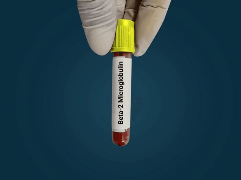 Beta-2 Microglobulin: Mối liên quan đến chức năng thận và ung thư